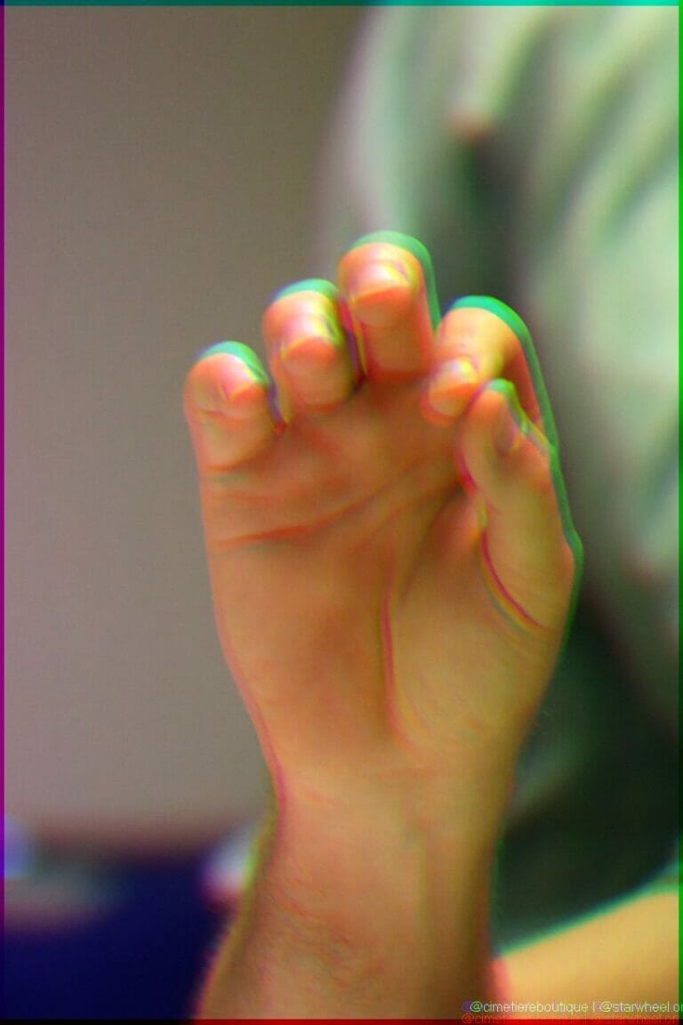 Dreams of Parallelization 