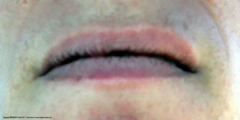 In Your Dreams, Entrapped 